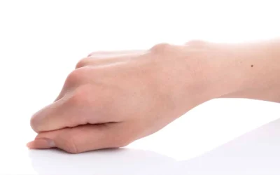 Ganglion ali ganglionska cista